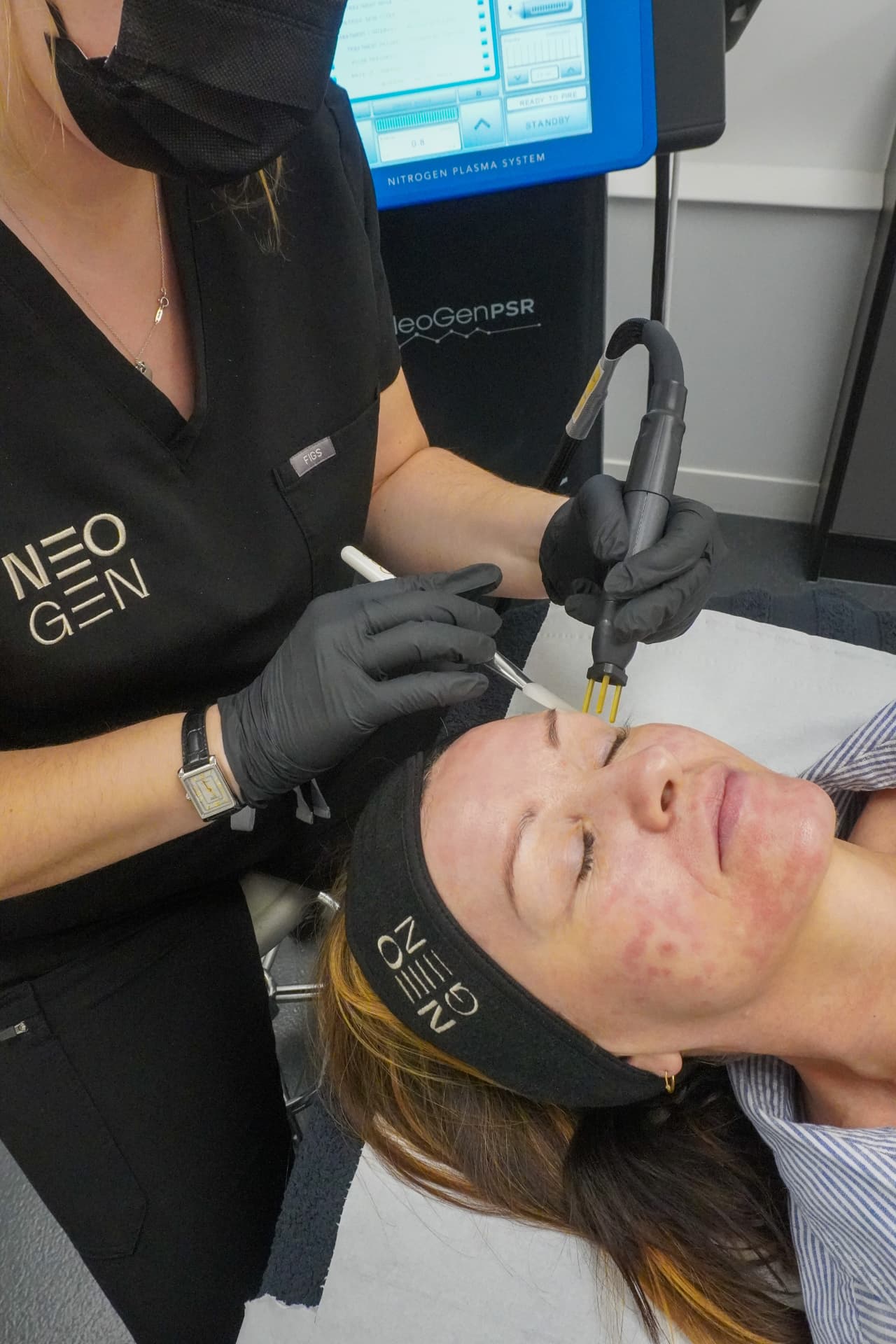 Neogen Face Lift treatment being performed at iCRYO SouthPark